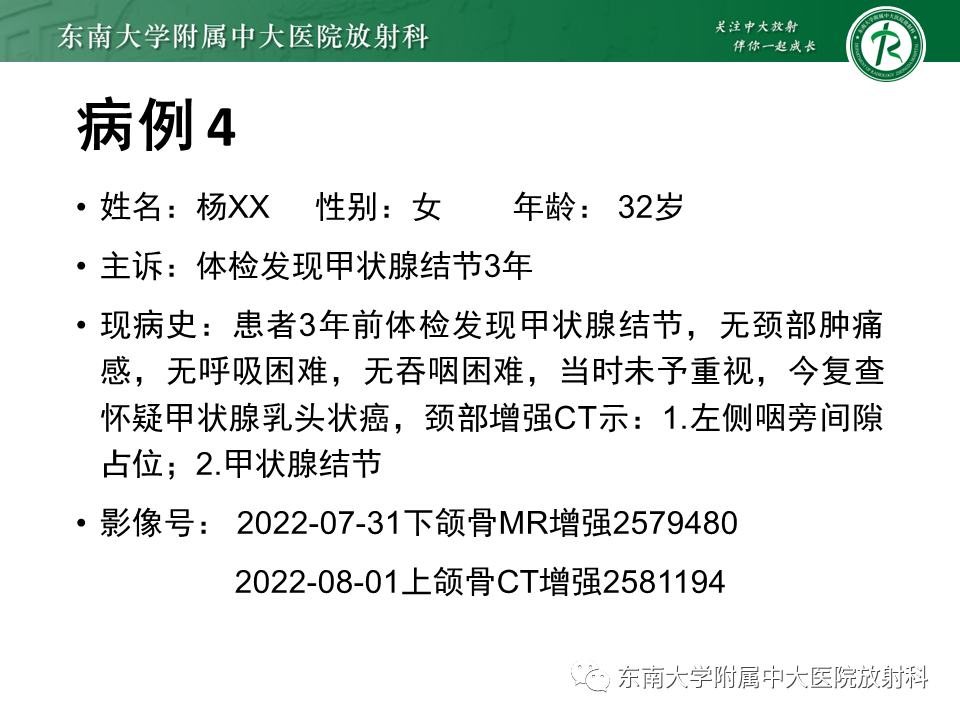 影像PPT - 【PPT】多形性腺瘤-29