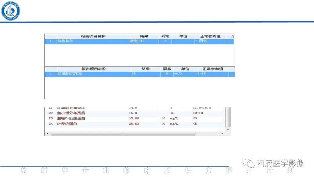 影像PPT - 【病例】脊柱结核腰椎结核1例MR影像表现与鉴别-3