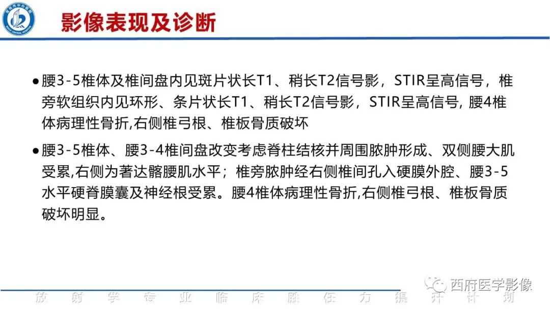 影像PPT - 【病例】脊柱结核腰椎结核1例MR影像表现与鉴别-8