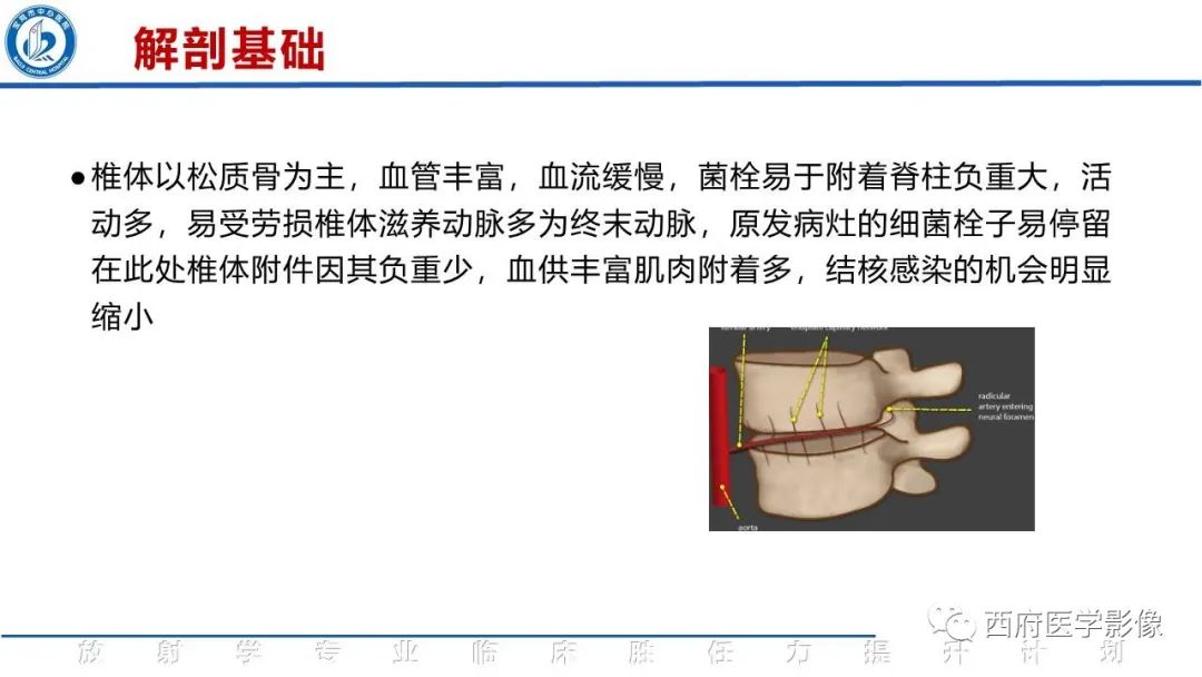 影像PPT - 【病例】脊柱结核腰椎结核1例MR影像表现与鉴别-10