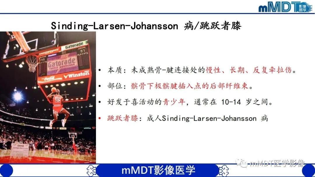 影像PPT - 【PPT】非肿瘤性前膝疼痛综合征MR评估—基于解剖层次视角-17 影像PPT - 【PPT】非肿瘤性前膝疼痛综合征MR评估—基于解剖层次视角-17