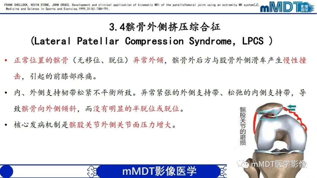 影像PPT - 【PPT】非肿瘤性前膝疼痛综合征MR评估—基于解剖层次视角-27 影像PPT - 【PPT】非肿瘤性前膝疼痛综合征MR评估—基于解剖层次视角-27
