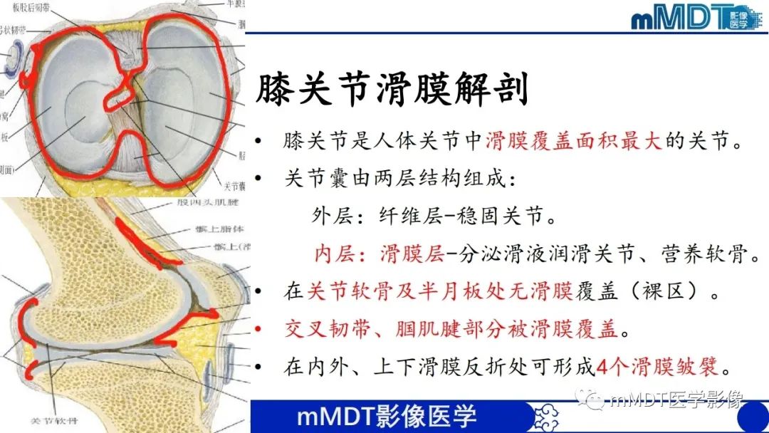 影像PPT - 【PPT】非肿瘤性前膝疼痛综合征MR评估—基于解剖层次视角-38 影像PPT - 【PPT】非肿瘤性前膝疼痛综合征MR评估—基于解剖层次视角-38