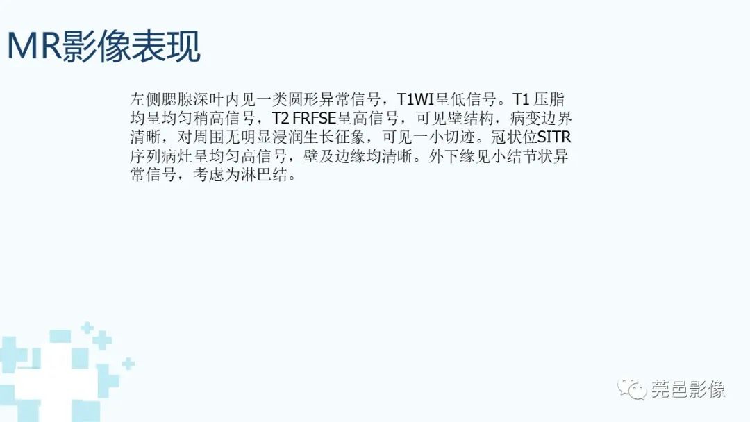 影像PPT - 【PPT】一例腮腺粘液囊肿病例分享-13