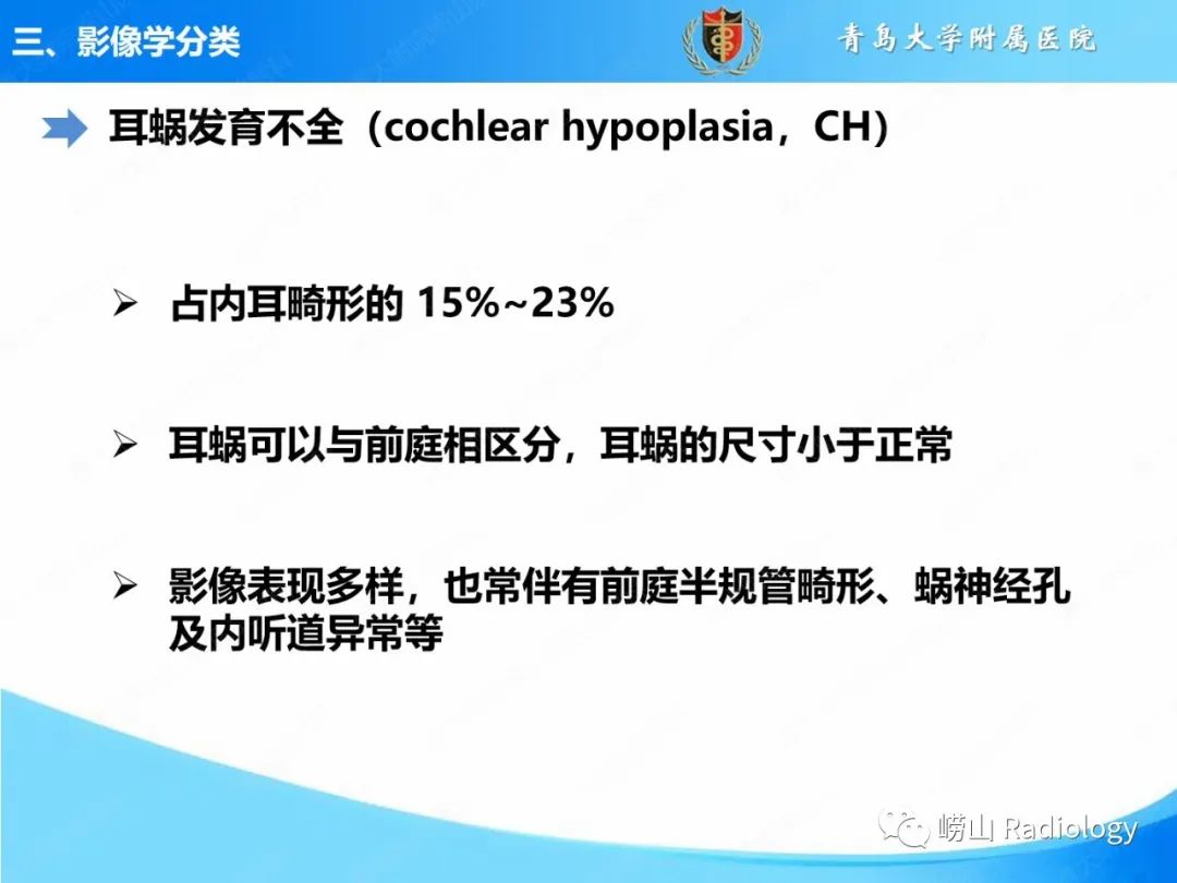 影像PPT - 【PPT】内耳畸形的影像学诊断-29