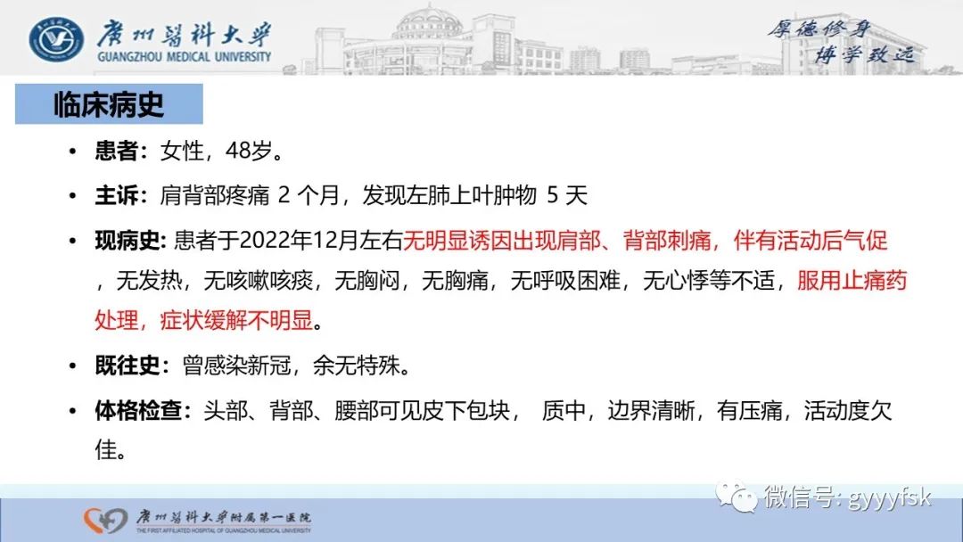 影像PPT - 【PPT】马尔尼菲篮状菌病-2