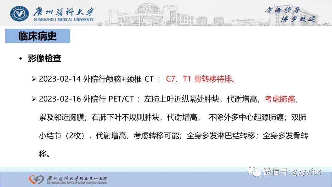 影像PPT - 【PPT】马尔尼菲篮状菌病-3