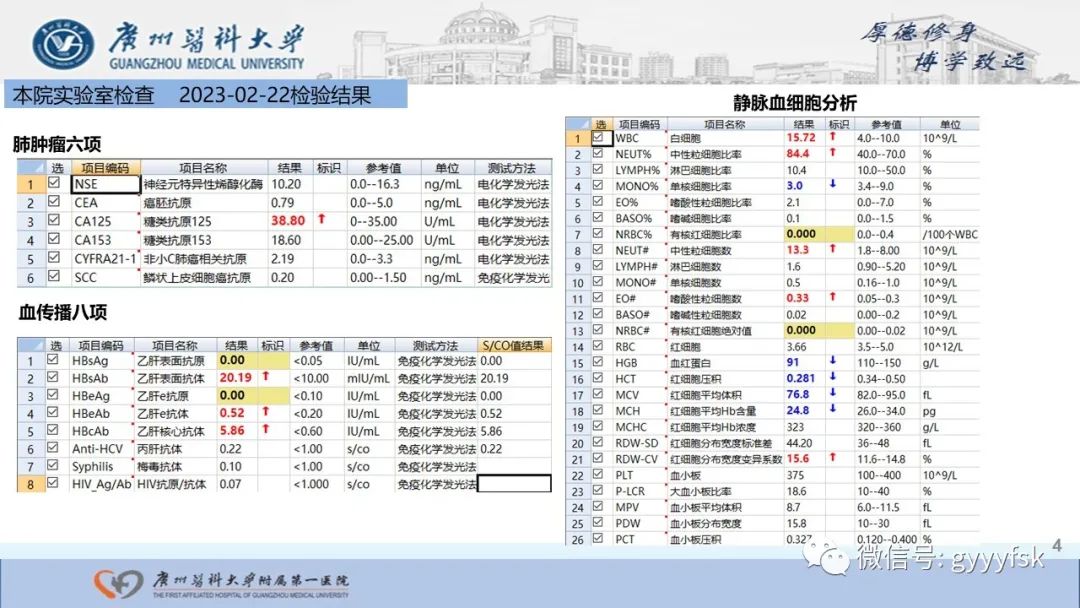 影像PPT - 【PPT】马尔尼菲篮状菌病-4