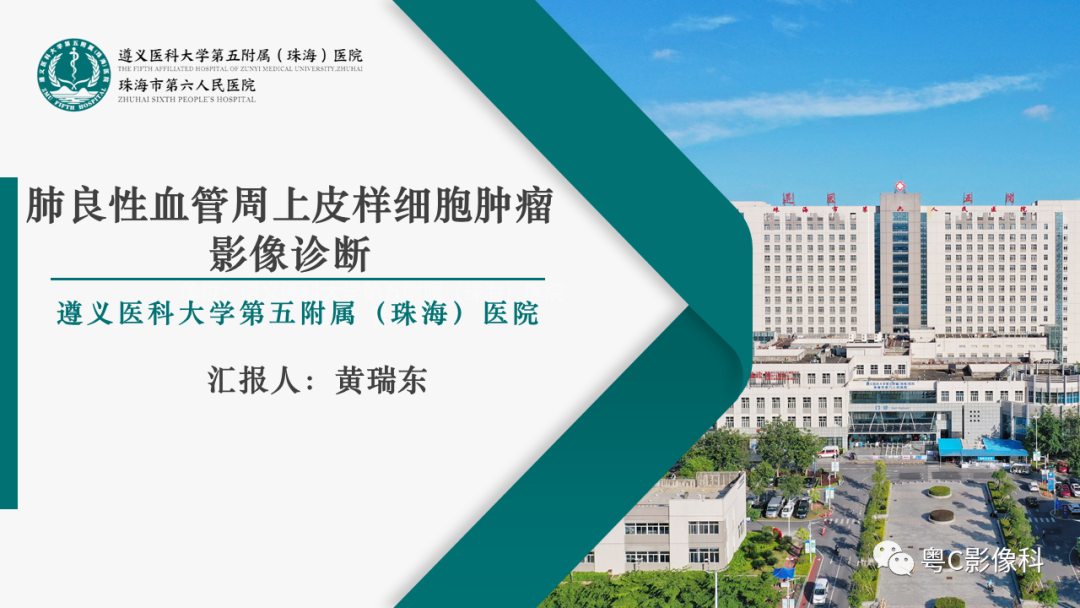 影像PPT - 【PPT】肺良性血管周上皮样细胞肿瘤影像诊断-1