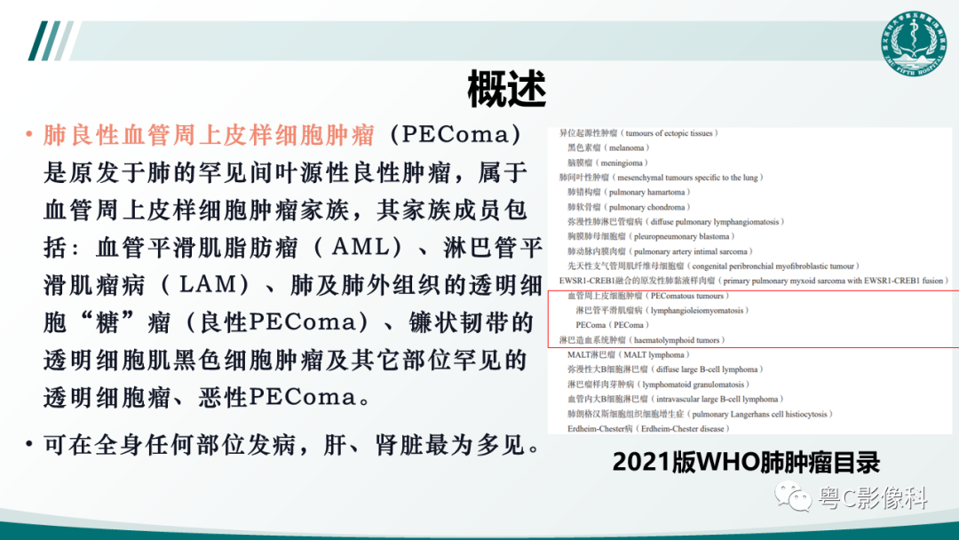 影像PPT - 【PPT】肺良性血管周上皮样细胞肿瘤影像诊断-16