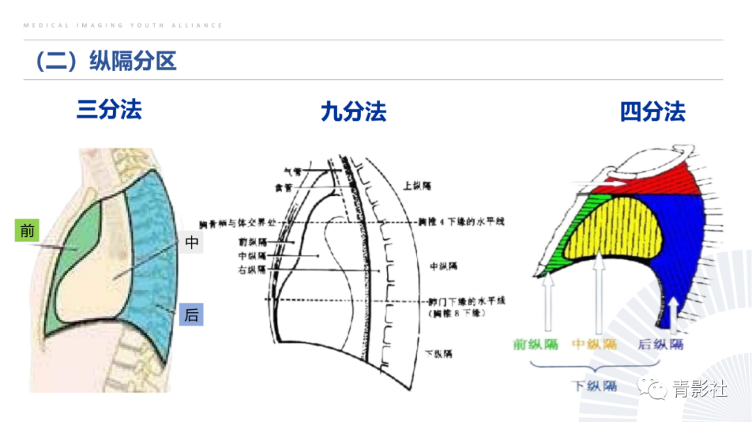 影像PPT - 【PPT】纵隔血管前区疾病的影像诊断思路-4