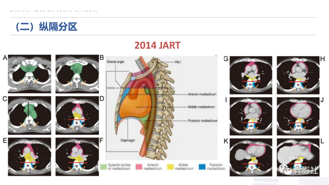 影像PPT - 【PPT】纵隔血管前区疾病的影像诊断思路-5