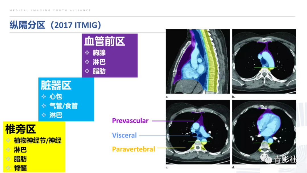 影像PPT - 【PPT】纵隔血管前区疾病的影像诊断思路-7
