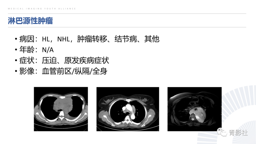 影像PPT - 【PPT】纵隔血管前区疾病的影像诊断思路-33