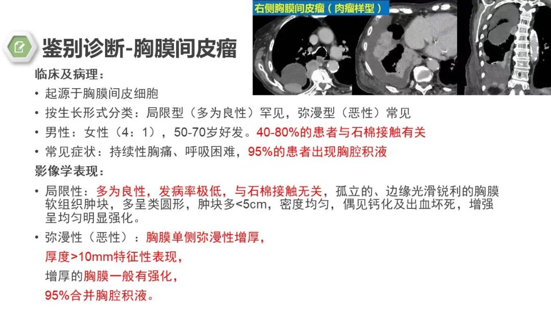 影像PPT - 【病例】胸膜中间型血管瘤1例CT影像-13 影像PPT - 【病例】胸膜中间型血管瘤1例CT影像-13