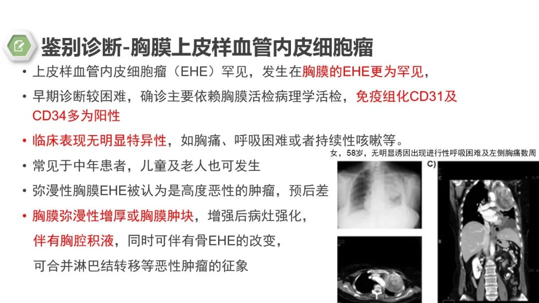 影像PPT - 【病例】胸膜中间型血管瘤1例CT影像-17 影像PPT - 【病例】胸膜中间型血管瘤1例CT影像-17