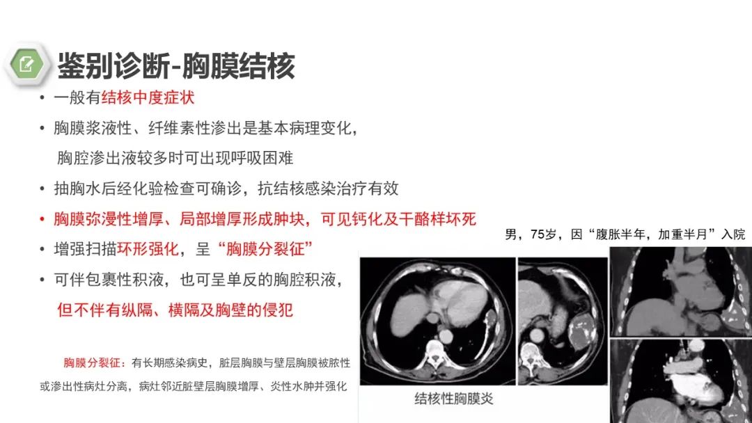 影像PPT - 【病例】胸膜中间型血管瘤1例CT影像-18 影像PPT - 【病例】胸膜中间型血管瘤1例CT影像-18