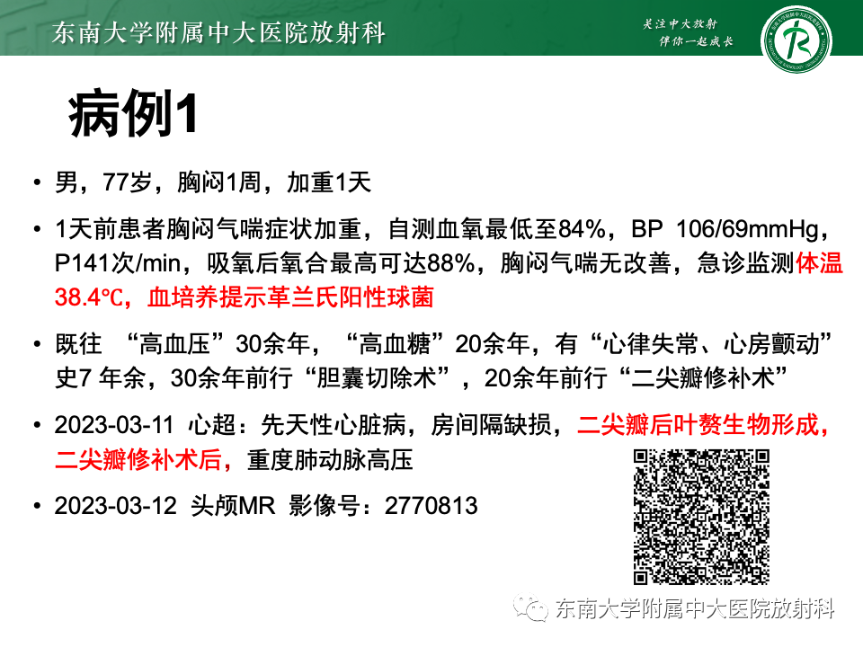 影像PPT - 【PPT】非对称、多灶性脑白质受累为主病例随访-1