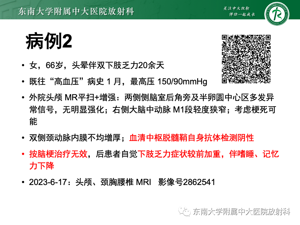 影像PPT - 【PPT】非对称、多灶性脑白质受累为主病例随访-4