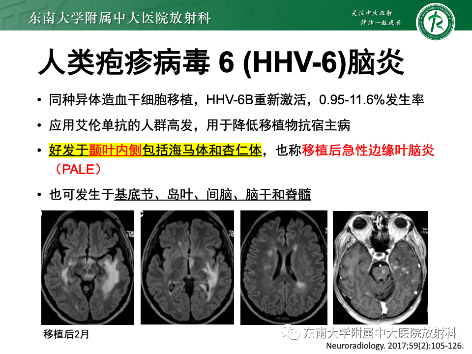 影像PPT - 【PPT】非对称、多灶性脑白质受累为主病例随访-25