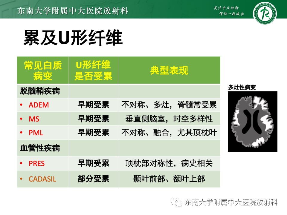 影像PPT - 【PPT】非对称、多灶性脑白质受累为主病例随访-34