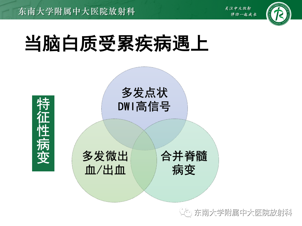 影像PPT - 【PPT】非对称、多灶性脑白质受累为主病例随访-36