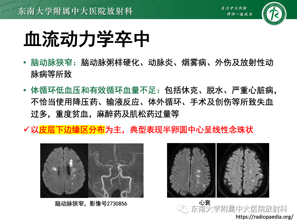 影像PPT - 【PPT】非对称、多灶性脑白质受累为主病例随访-38