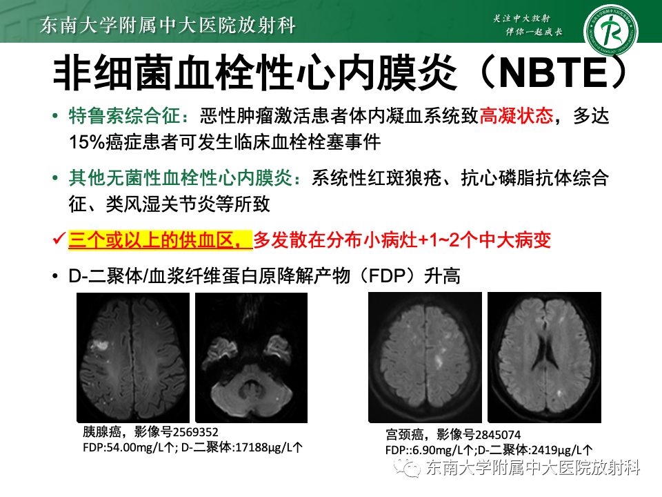 影像PPT - 【PPT】非对称、多灶性脑白质受累为主病例随访-40