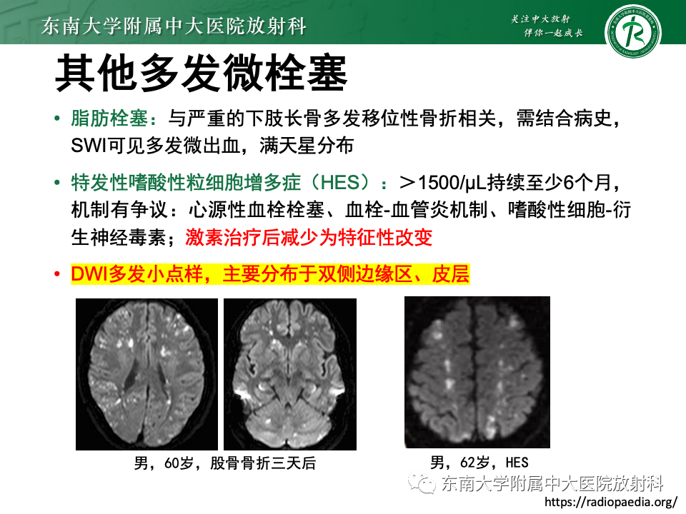 影像PPT - 【PPT】非对称、多灶性脑白质受累为主病例随访-41