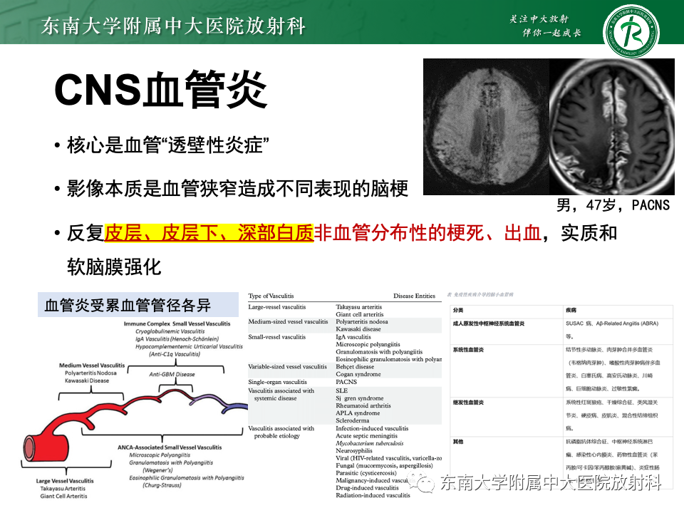 影像PPT - 【PPT】非对称、多灶性脑白质受累为主病例随访-48