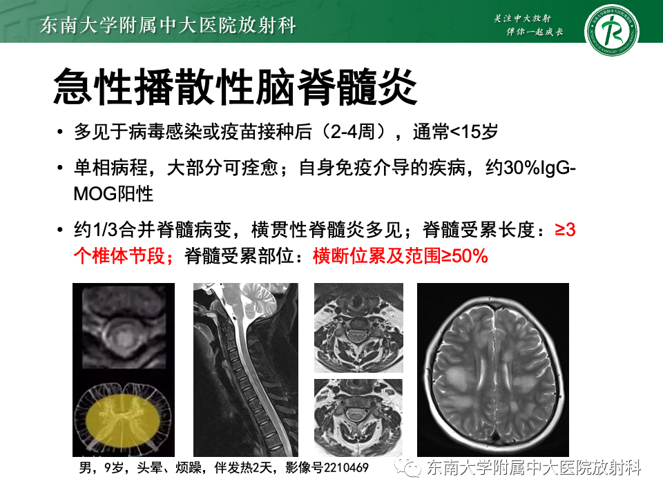 影像PPT - 【PPT】非对称、多灶性脑白质受累为主病例随访-57