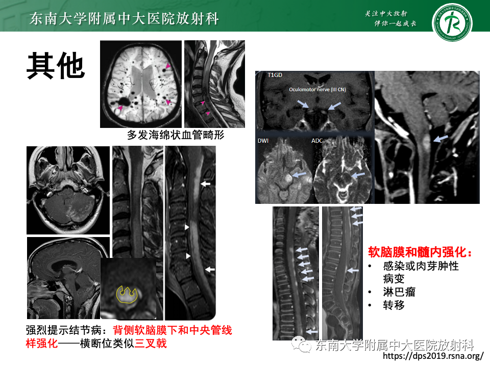 影像PPT - 【PPT】非对称、多灶性脑白质受累为主病例随访-58