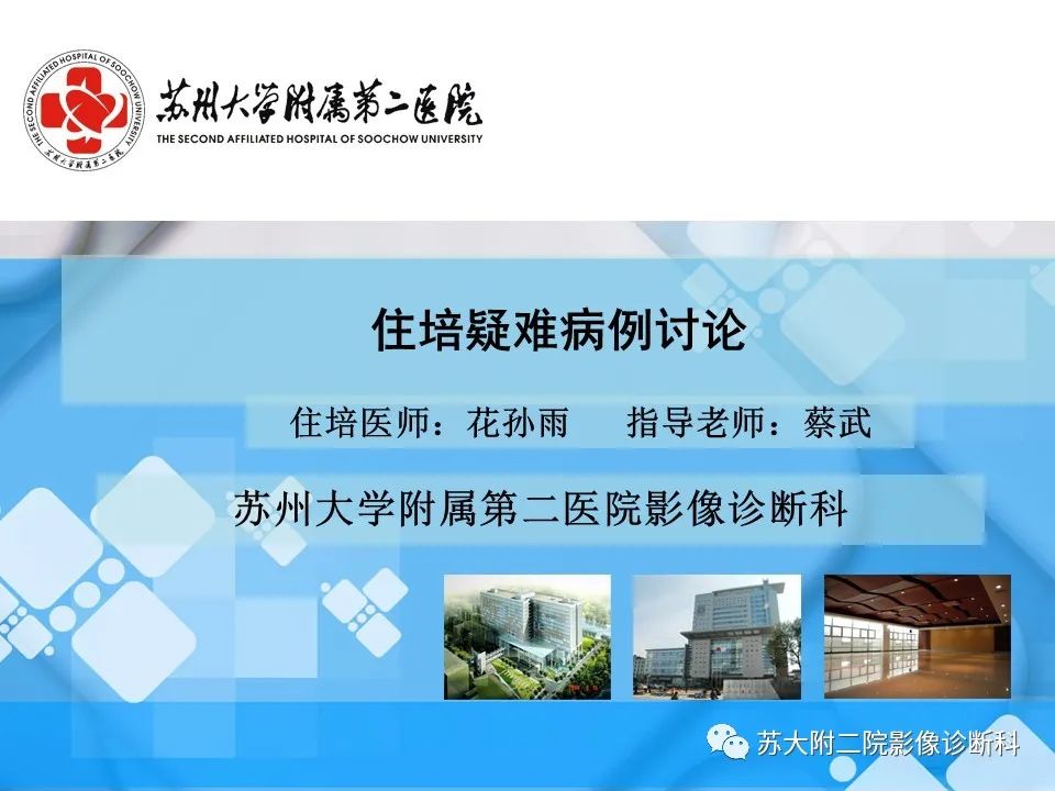 影像PPT - 【PPT】脾脏囊状淋巴管瘤 & 窦岸细胞血管瘤 & 硬化性血管瘤样结节转化-1