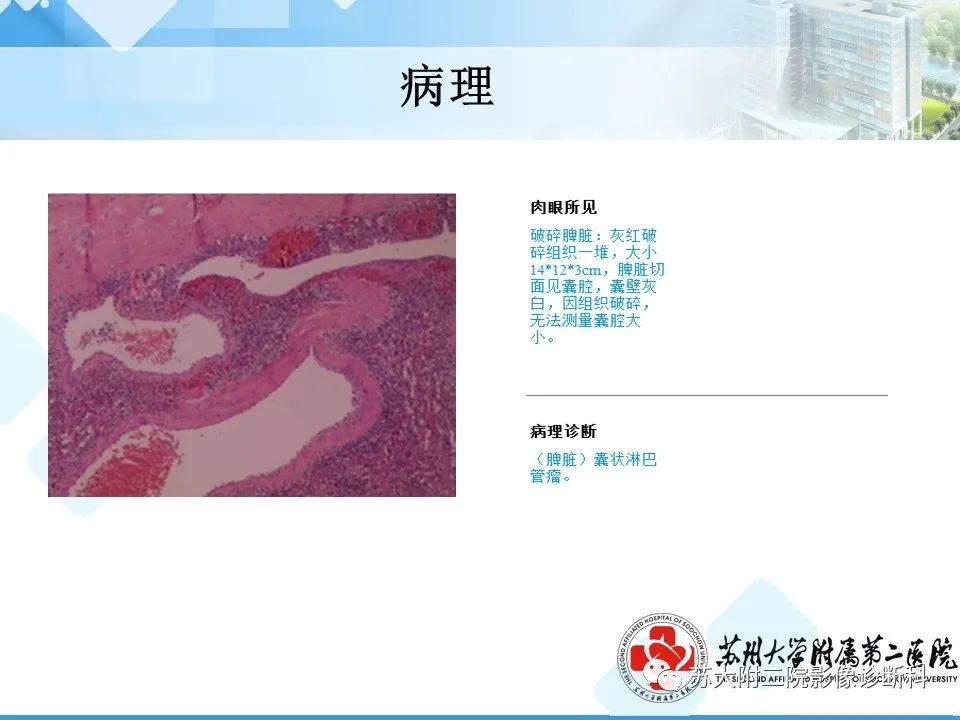 影像PPT - 【PPT】脾脏囊状淋巴管瘤 & 窦岸细胞血管瘤 & 硬化性血管瘤样结节转化-6