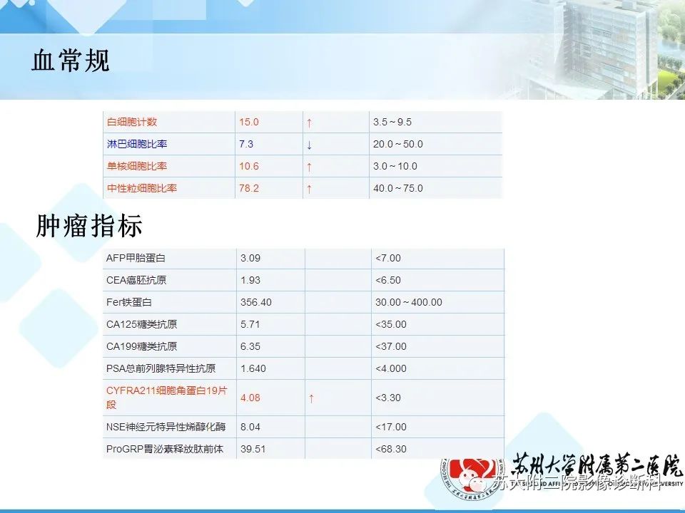 影像PPT - 【PPT】脾脏囊状淋巴管瘤 & 窦岸细胞血管瘤 & 硬化性血管瘤样结节转化-14