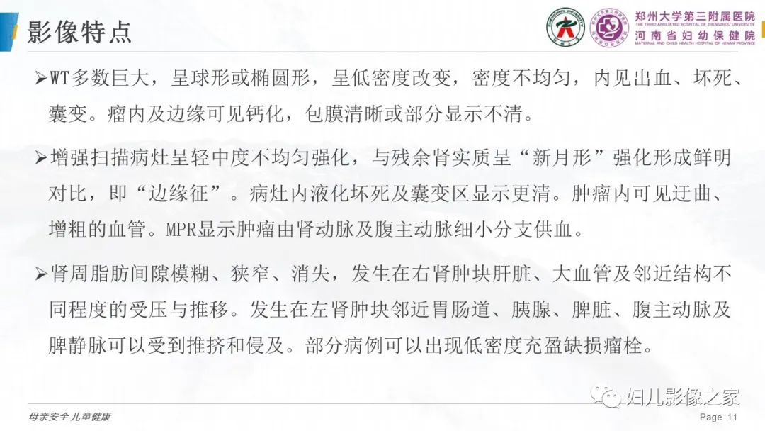 影像PPT - 【PPT】儿童肾母细胞瘤的影像诊断-10