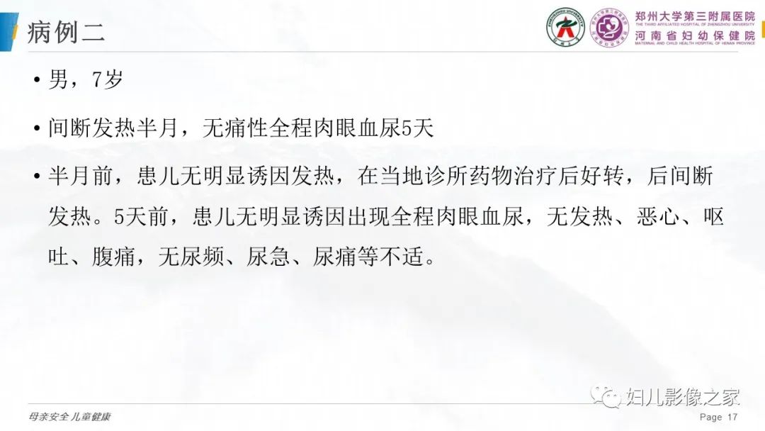 影像PPT - 【PPT】儿童肾母细胞瘤的影像诊断-16