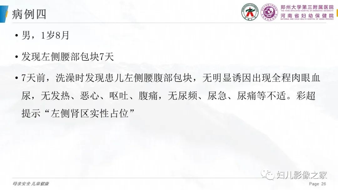 影像PPT - 【PPT】儿童肾母细胞瘤的影像诊断-25