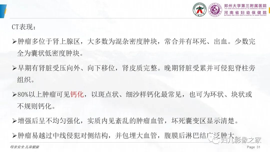 影像PPT - 【PPT】儿童肾母细胞瘤的影像诊断-30