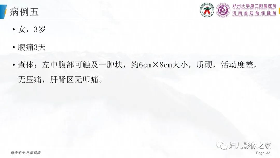 影像PPT - 【PPT】儿童肾母细胞瘤的影像诊断-31