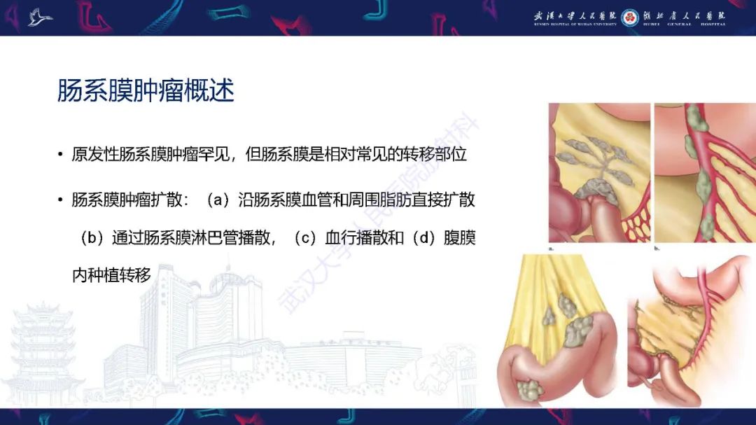影像PPT - 【PPT】肠系膜实性肿块影像诊断-4