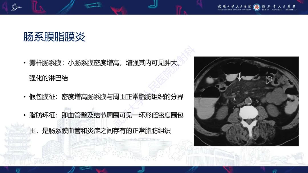 影像PPT - 【PPT】肠系膜实性肿块影像诊断-7