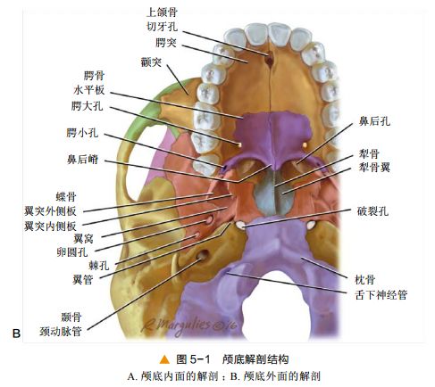 影像PPT - 颅底CT及鼻窦轴冠矢解剖图-2