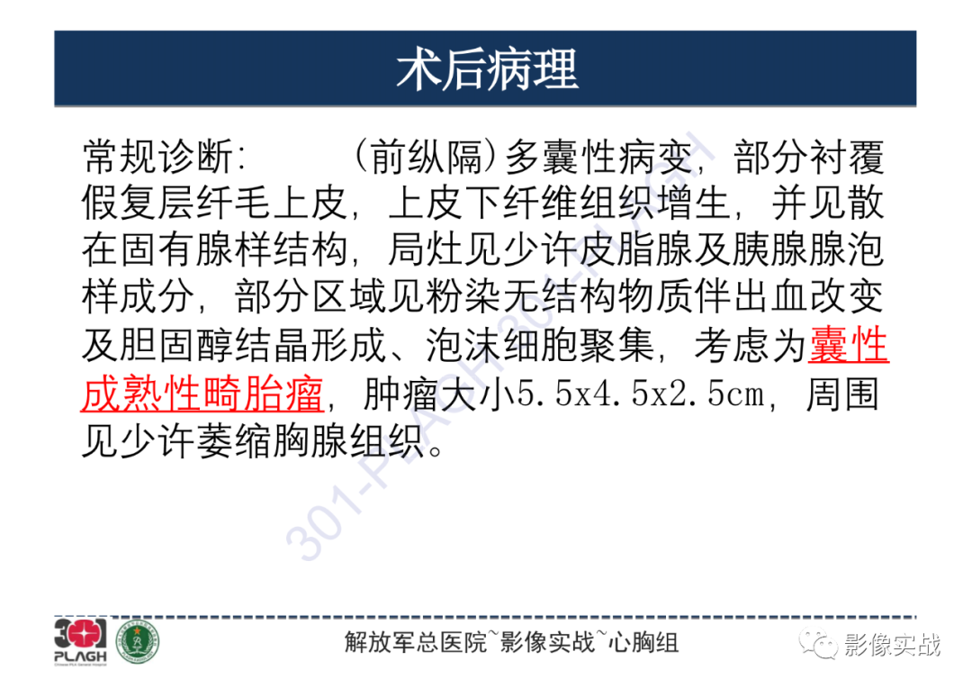 影像PPT - 【病例】纵隔畸胎瘤1例CT影像-15