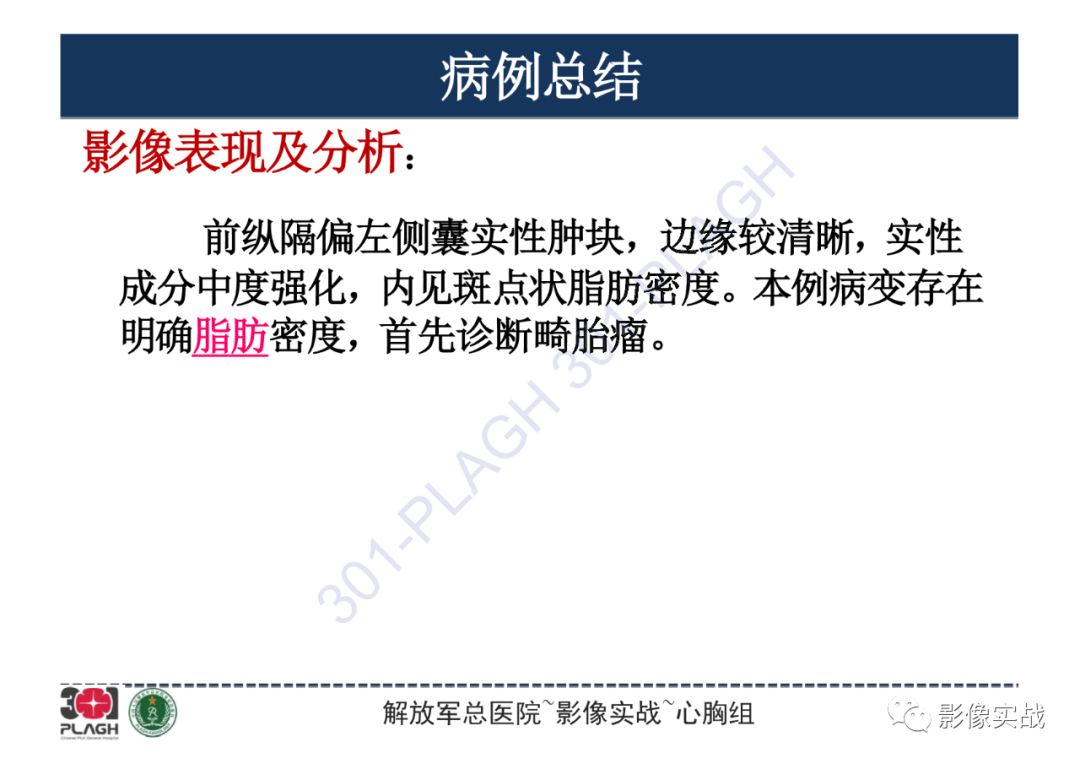 影像PPT - 【病例】纵隔畸胎瘤1例CT影像-16