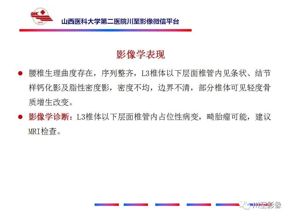 影像PPT - 【PPT】椎管内畸胎瘤-5 影像PPT - 【PPT】椎管内畸胎瘤-5