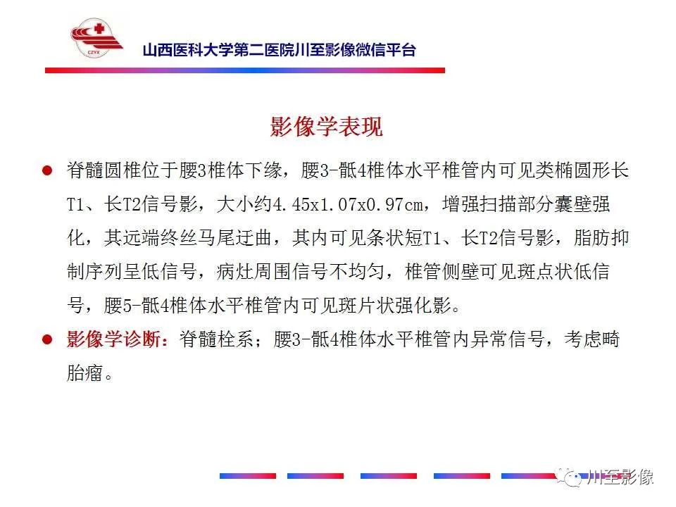 影像PPT - 【PPT】椎管内畸胎瘤-10 影像PPT - 【PPT】椎管内畸胎瘤-10
