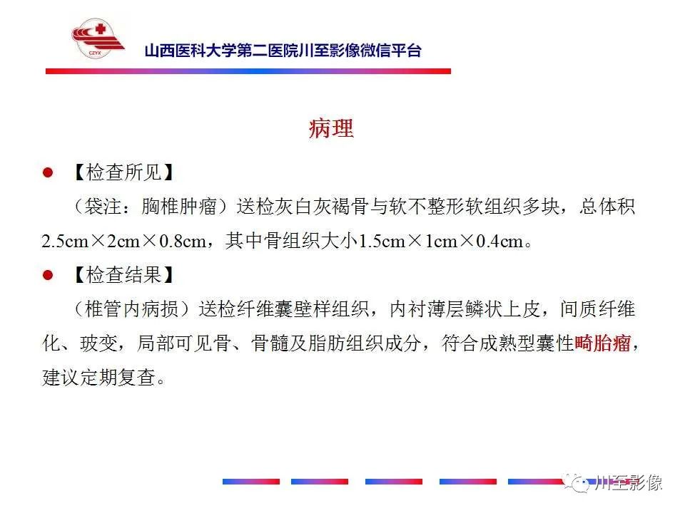 影像PPT - 【PPT】椎管内畸胎瘤-12 影像PPT - 【PPT】椎管内畸胎瘤-12
