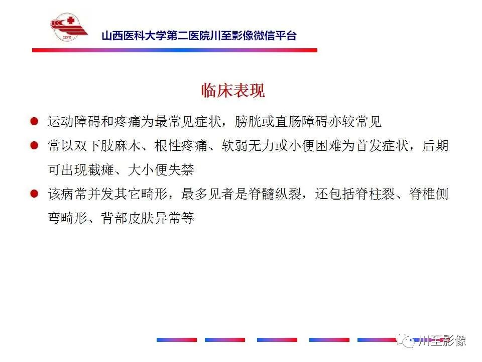 影像PPT - 【PPT】椎管内畸胎瘤-15 影像PPT - 【PPT】椎管内畸胎瘤-15