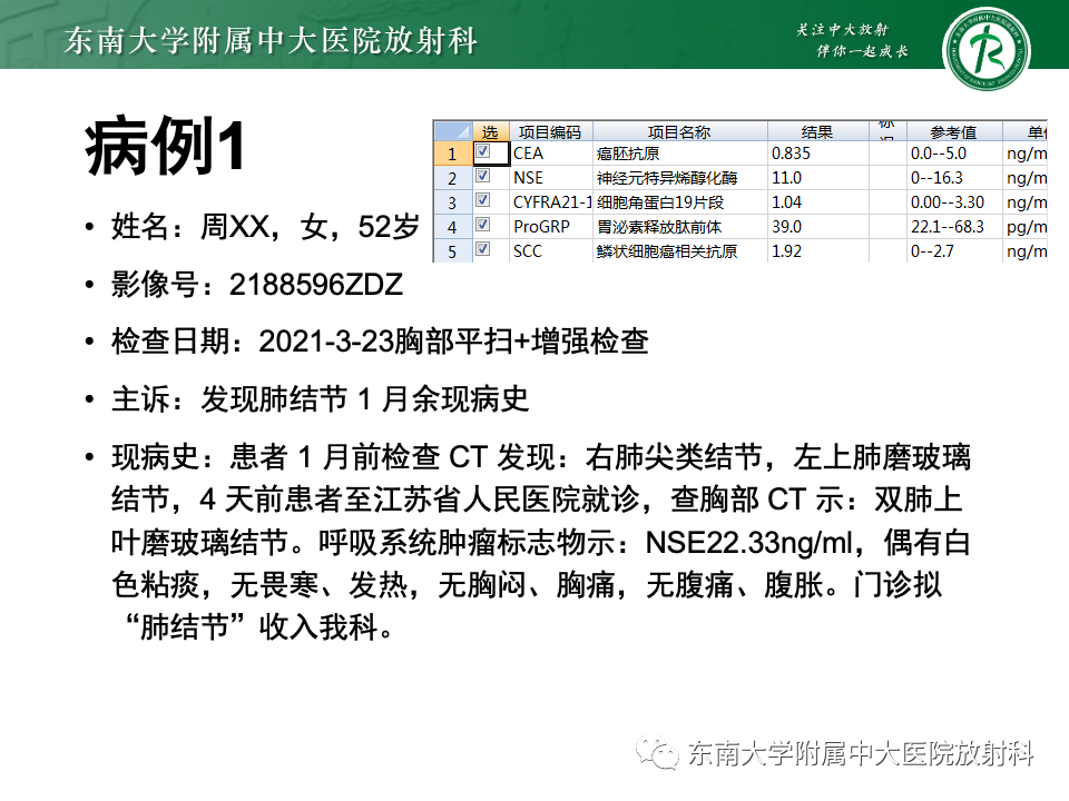 影像PPT - 【PPT】肺腺癌的CT影像表现-3 影像PPT - 【PPT】肺腺癌的CT影像表现-3